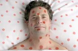 В столице зафиксировано 66 случаев заболевания корью