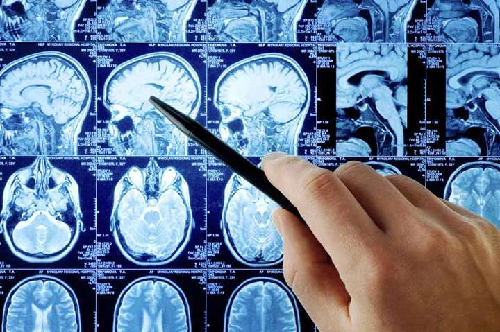 Ученые создали нейросеть, которая воссоздает изображения из мозговой активности человека