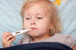 Хвора на кір дитина