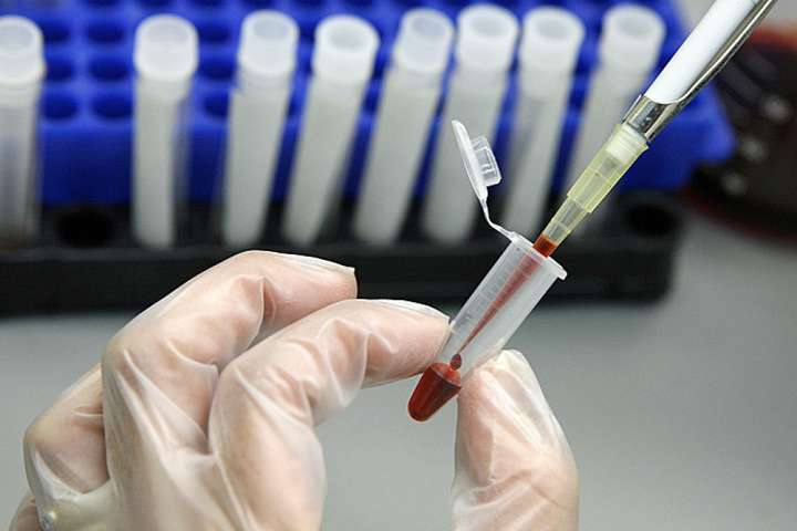 Спалах гепатиту А в Миколаєві: кількість хворих зросла до 77 осіб 