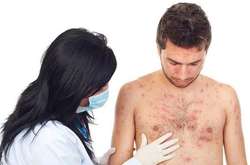 Окупованим Донбасом масово шириться кір