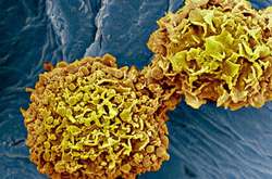 Рак молочної залози може бути виявлений новим тестом