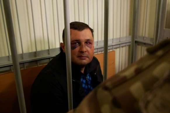 До суду доставили Шепелєва з жахливими синцями на обличчі (фото)