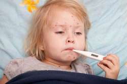 За два місяці в Україні на кір захворіли більше п’яти тисяч людей