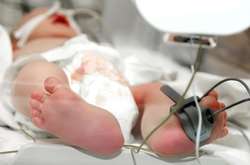 П'ятимісячна дитина померла від кору в Одеській області