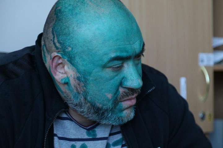 <span>Юрій Крисін у дитячому відділенні Інститута серця в Києві, 26 лютого 2018 року</span> - «Шкаф» та його скелети. Справа Крисіна як вирок українському правосуддю