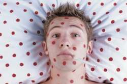 Окупанти на Донбасі масово хворіють на кір – штаб АТО