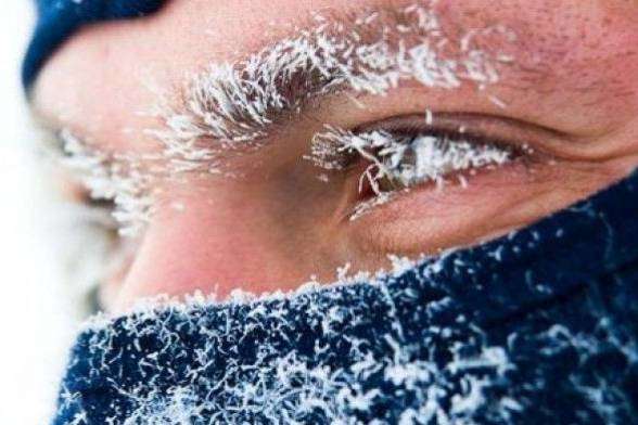 28 випадків обмороження зафіксовано на Вінниччині