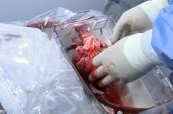 У Німеччині працюють над проектом друку людських органів на 3D-принтері