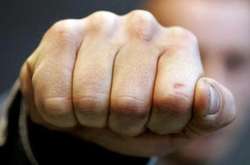 Під Києвом побили депутата від «Укропу»