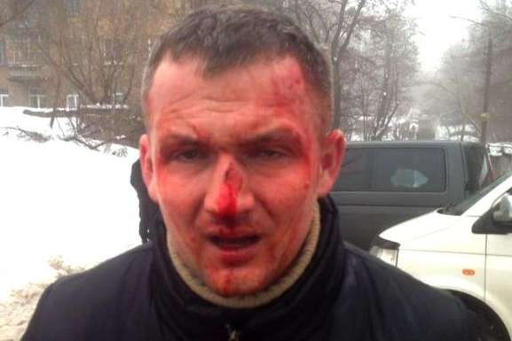 Юрій Левченко - Історія з побиттям нардепа Левченка - українська реальність в мініатюрі