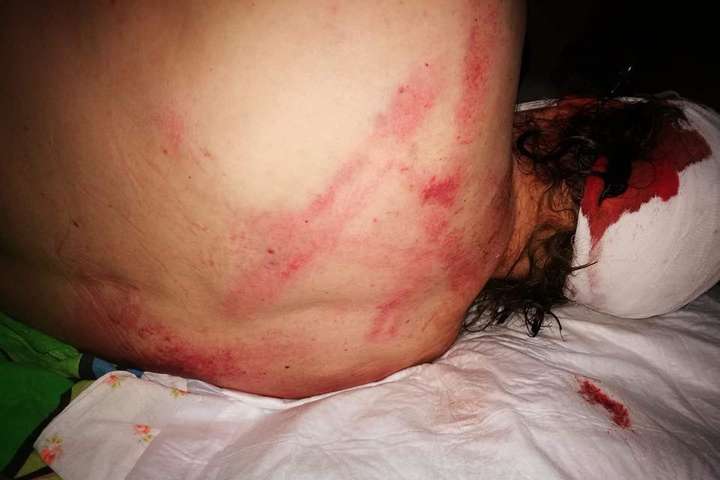 У Кривому Розі жорстоко побили громадського діяча: моторошні фото
