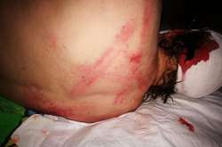 У Кривому Розі жорстоко побили громадського діяча: моторошні фото