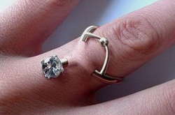 Имплантированный бриллиант в безымянном пальце