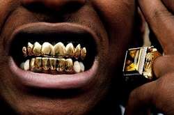 Золотая челюсть: фотографии самых странных и нелепых «зубных» украшений знаменитостей