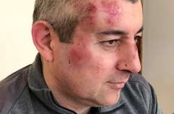 В Росії знову напали на представника правозахисної організації