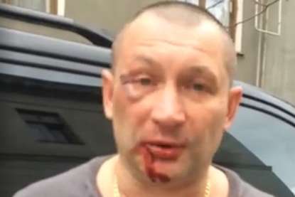 «В Криму небезпечно бути українцем»: Чоловіка побили за українську символіку