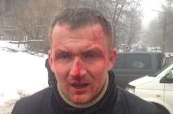 9 березня на Татарці побили нардепа Юрія Левченка