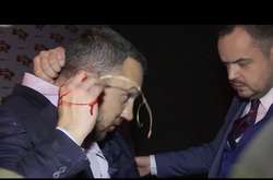 Нардепи Мельничук і Лінько побилися після телеефіру 