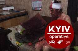 Охоронець столичного парку знайшов голу і побиту жінку (шокуючі фото)