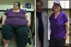 Невероятные снимки до и после похудения