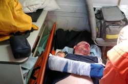 У Кременчуці жорстоко побили активіста: невідомі увірвалися просто у дім