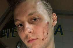 Побиття Шуфрича-молодшого: поліція вивчить відео з камер