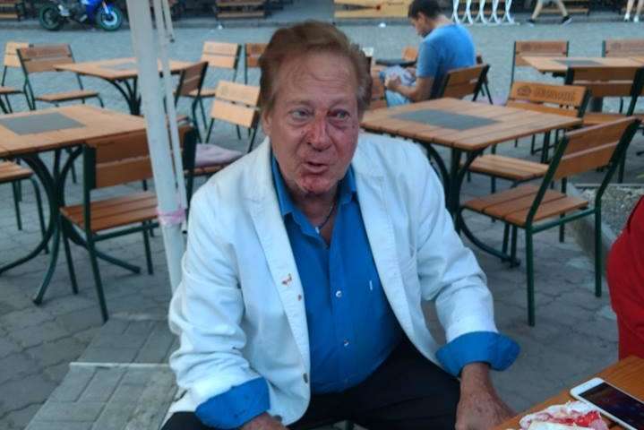 В Одесі побили 71-річного американського співака 