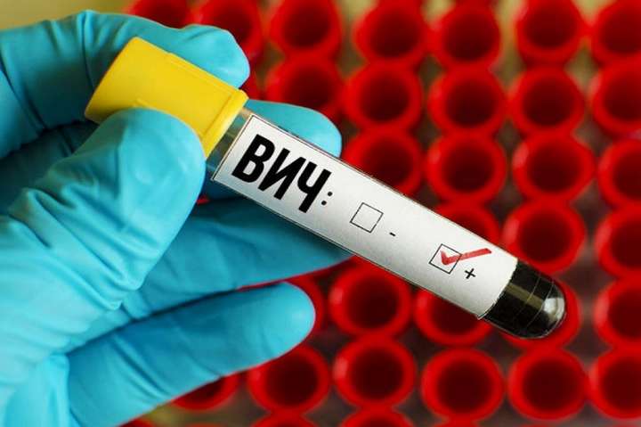 Немцам разрешат проводить тесты на ВИЧ самостоятельно