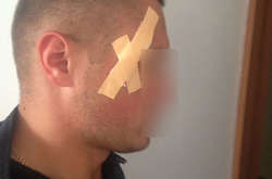 На Ровенщине протестующие избили полицейских - восемь пострадавших