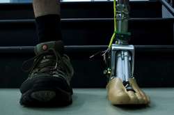 Чудо протезирования: искусственные ноги теперь движутся, как настоящие