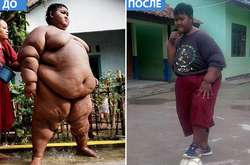 Фотографии мальчика до и после похудения