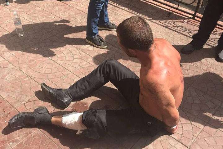 Патрульні прострелили ногу чоловіку, який напав на них у Києві