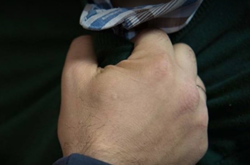 На Вінниччині господар «випроваджував» гостя ледь не до смерті