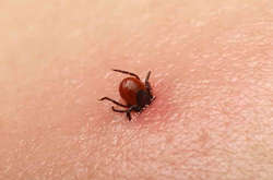 Кліщі атакують: у лікарнях Києва 21 людина із хворобою Лайма 