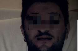 Опубліковано фото полоненого росіянина на Донбасі 