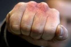 На Львовщине старшина избил подчиненного: у солдата разрыв селезенки