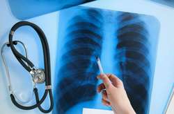 Киян закликають обстежитись на пересувному флюорографі (графік)