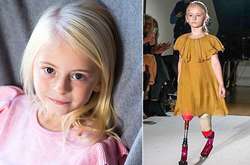 Семилетняя девочка с ампутированными ногами стала моделью известного бренда одежды