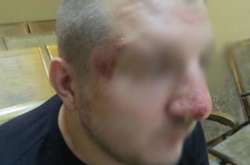 Українець каже, що його побили російські прикордонники 