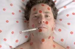 На півдні Молдови через спалах кору скасували усі масові заходи