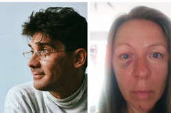  Актор Кошелєв побив жінку 