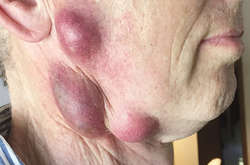 Человек подцепил опасную болезнь после близкого контакта с кошкой