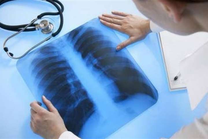 У виховательки дитсадка у Бердянську виявили туберкульоз