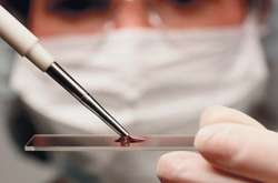 Українцям пояснили, за яких умов можна безкоштовно здати аналізи