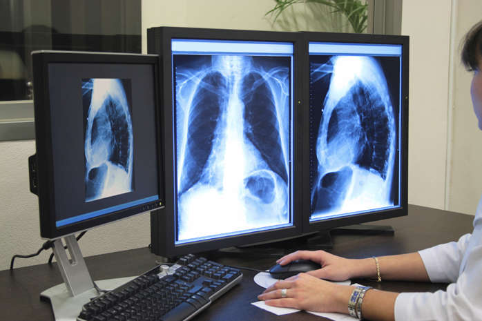 Київ купить цифровий рентген для діагностування туберкульозу