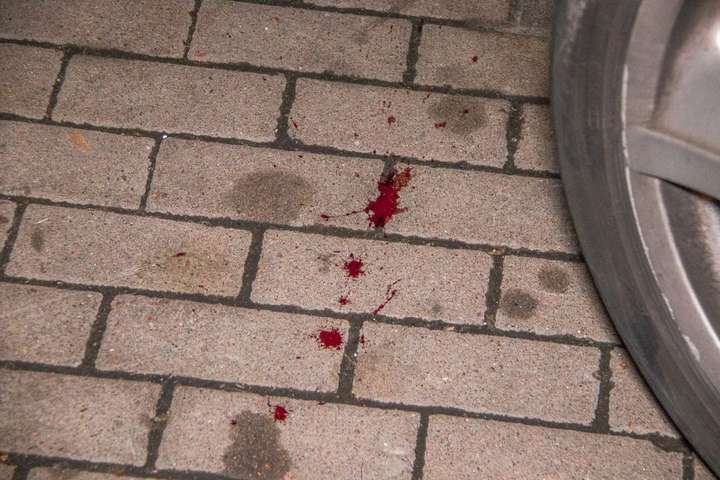 У центрі Києва пара на Maybach прострелила ногу чоловікові біля бару