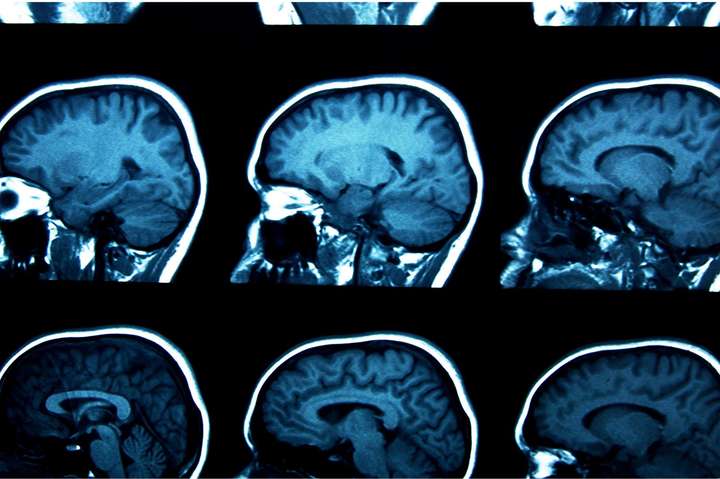 Ученые разгадали 125-летнюю тайну мозга, которая поможет лечить эпилепсию