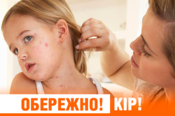 І знову спалах кору: найбільше хворіють діти