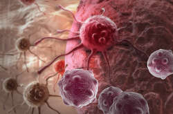 Рак корелюється зі стресом